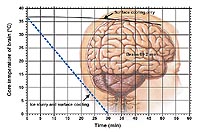 Chart shows how rapidly ice slurry cools the brain