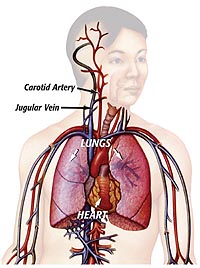 Diagram shows how ice slurry cools blood