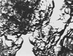 Smoother ice crystals make better slurries because they resist clotting in the body